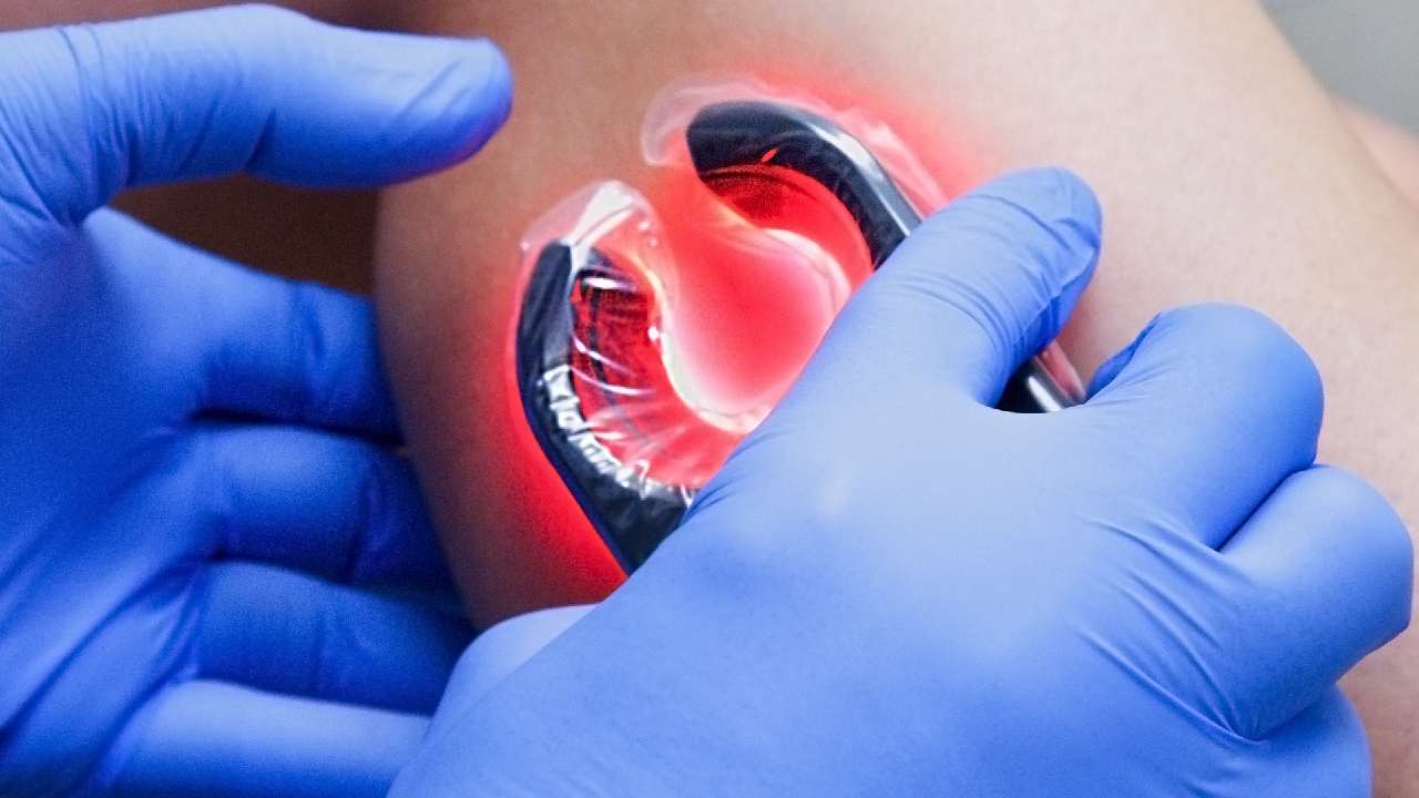 vein treatment in Bronx